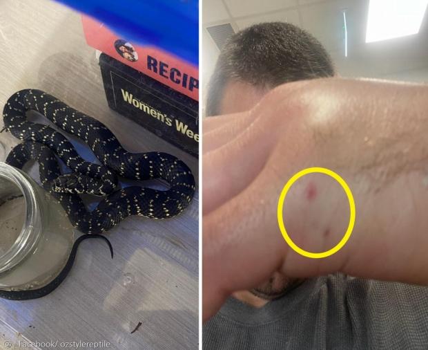 뱀한테 물려서 부어오른 손(오른쪽 사진). 왼쪽은 코브라과 독사 넓은머리뱀이다. [출처: 서던 하이랜드 스네이크 캐처의 페이스북]
