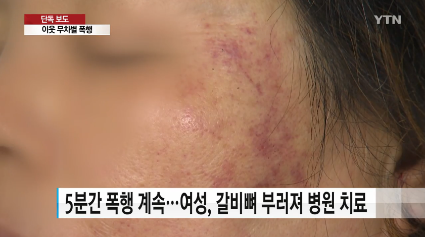 노트펫